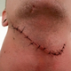 Image for article titled Counter-Strike Player Survives Having His Throat Cut